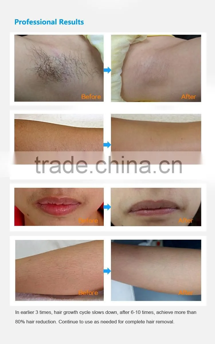 Mini laser hair removal machine permanent hair removal