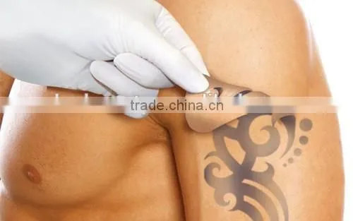 China Factory Laser Tattoo Removal Machine Price
