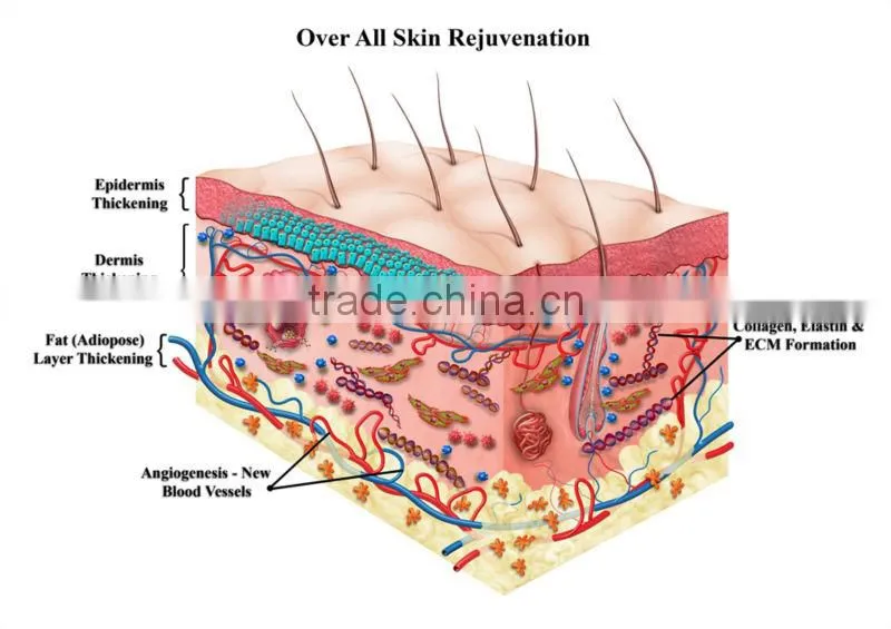 Pyrogen free ACD additive PRP tube for platelet rich plasma treatment