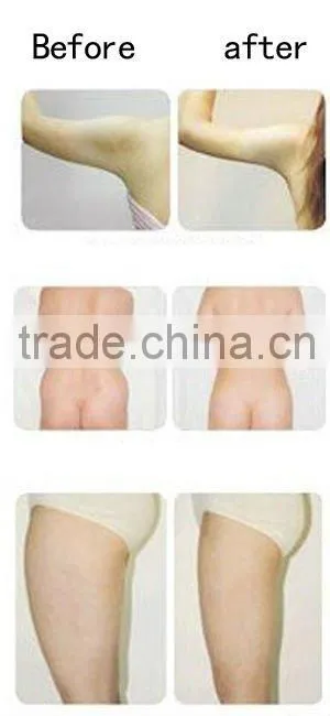 Hot sale !Beauty Equipment Ultrasonic Liposuction Slimming Equipment