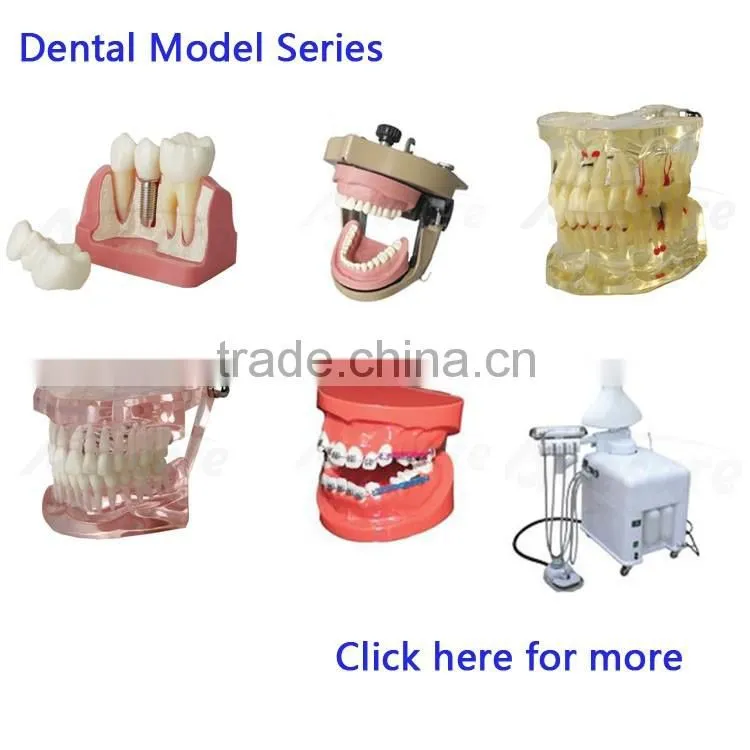 Educational Engine Model Dental Education Models for Sale