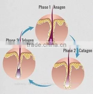 Most Attractive "Transformer" Design Inspiration Diode Laser In Motion Hair Removal Machine