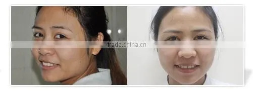 mesotherapy gun skin whitening facial care mesogun injector