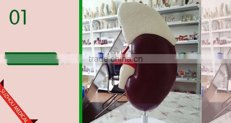 Kidney model with adrenal
