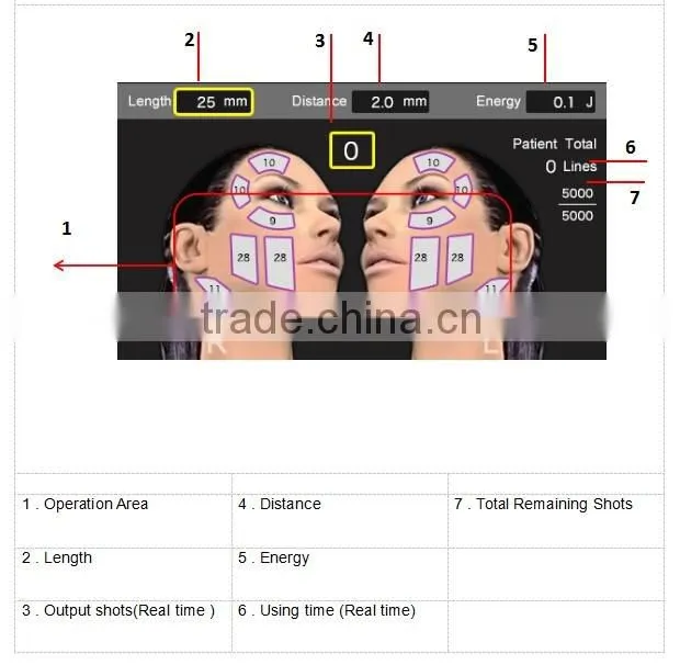 Portable smart 3D anti wrinkle treatment HIFU beauty machine
