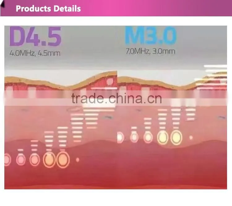 2016 Good effect 25mm focal length hifu vaginal tightening machine with CE certificate