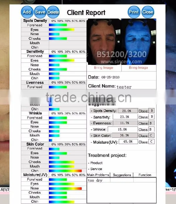 RGB/PL/UV tri-spectrum facial skin analyzer portable
