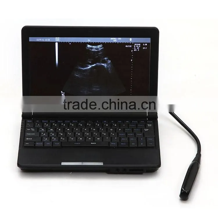China medical 6.5MHz rectal linear probe 3.5MHz Convex Probe portable laptop animal Ultrasound machine