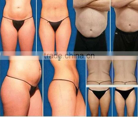 ABS material multi-functional ultrasound liposuction/weight loss machine