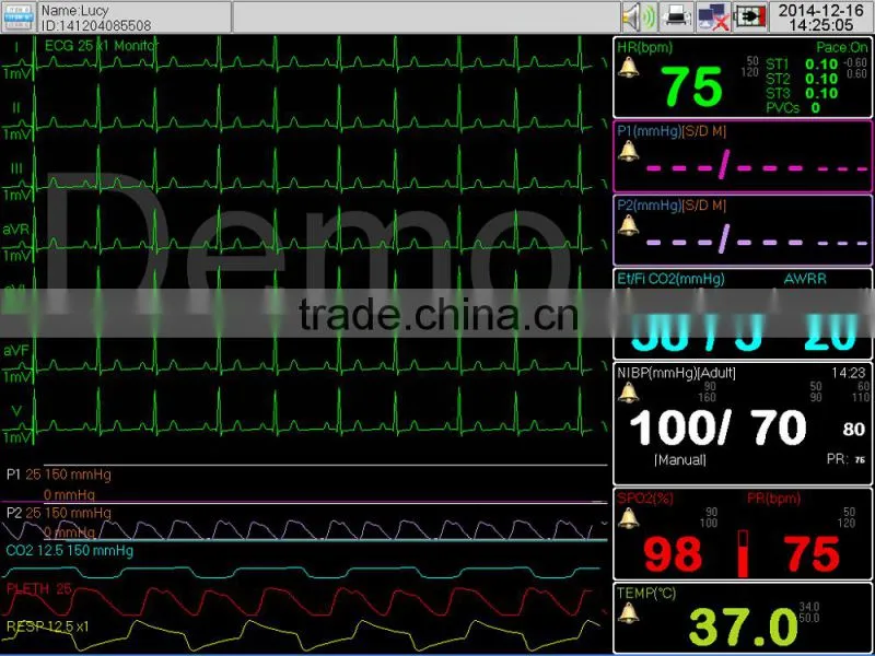 Patient vital signs monitor in recovery