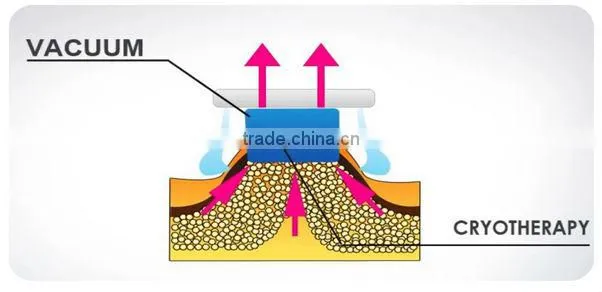 Protable 3 in1 best fat reduce slimming lipo laser and cryolipolisis criolipolisis