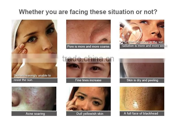 Wholesale beauty massage deep pore clean roller facial massage cream silicone facial cleansing brush