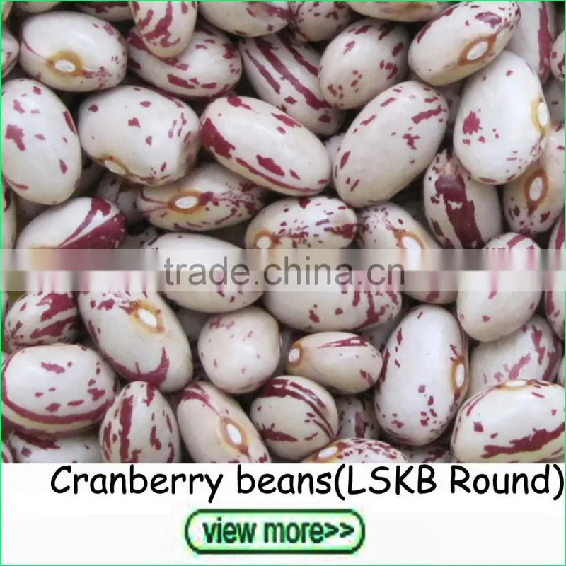 2016 Crop small size white kidney beans navy beans