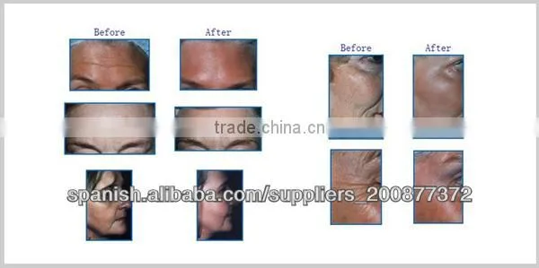 Newest style diamond microdermabrasion dermabrasion machine