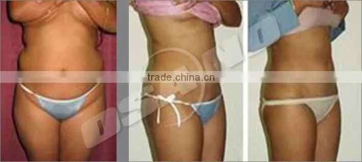 New Arrival 3 in 1 RF ultrasound cavitation body slimming machine