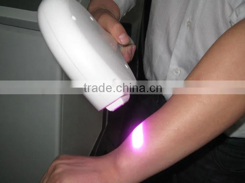 High performance 808nm diode laser hair removal machine,808nm diode laser for permanent hair removal