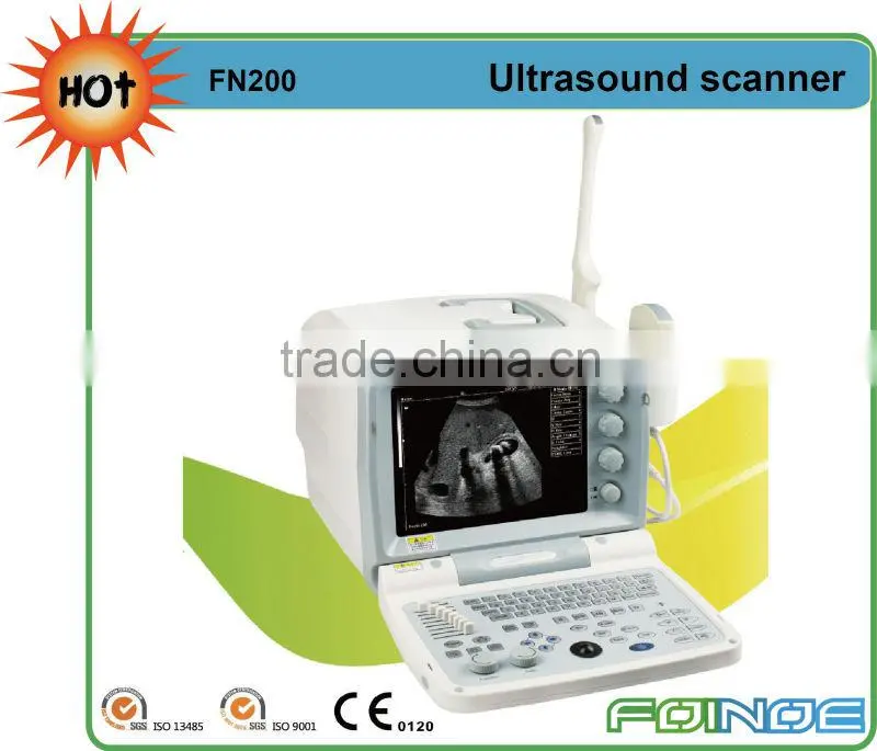 FN218 Full digital B model ultrasound probe usb
