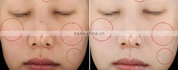 Best Lemon Papaya Whitening and Freckle Spots Remove Cream Aichun Freckle Removing Cream