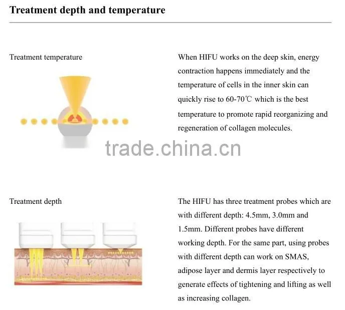 face lifting china beauty spa equipment / hifu beauty salon equipment