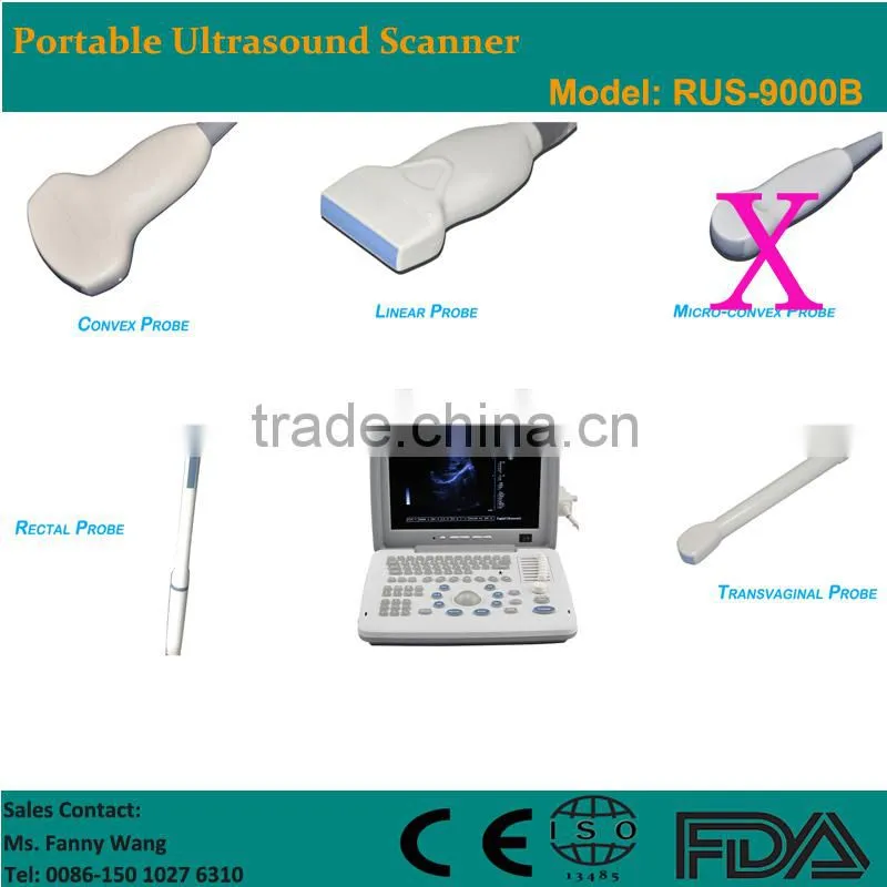 Factory price!CE approved Notebook B-Mode Ultrasound Scanner with 3.5Mhz multi-frequency convex probe RUS-9000B