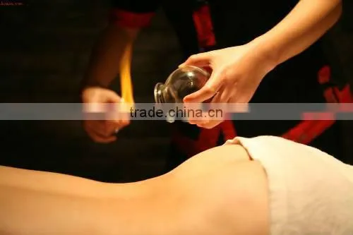 raditional fire cupping, glass cupping