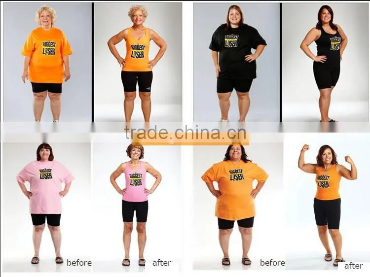 Fast result Ultrashape technology clinically proven FDA cleared hifu ultrasound machine FOR body slimming