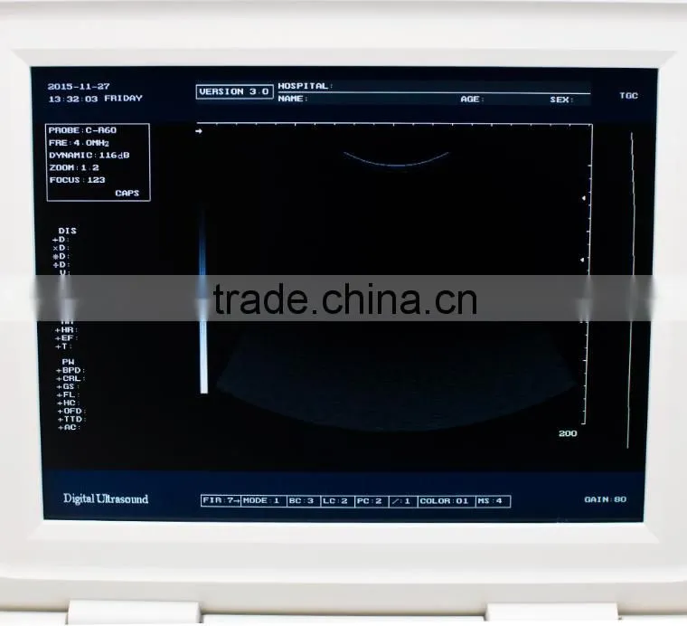 Ultrasonic, Optical, Electronic Equipments Laptop Portable B pc based ultrasound scanner
