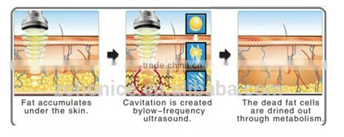 BD06C Vaccum & RF Roller + 40K Cavitation Slimming Machine