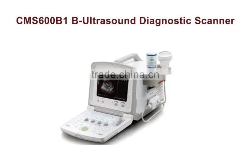 Medical chinese B-Ultrasound diagnostic scanner CMD600B1 ultrasound scanner