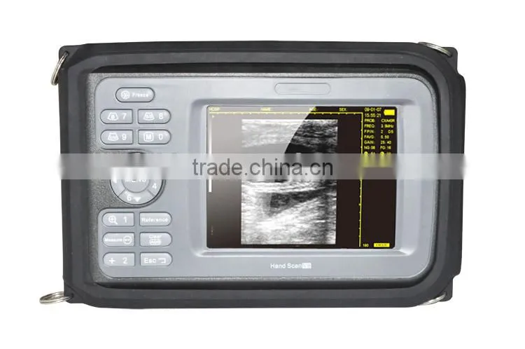 Handheld Digital PalmSmart Veterinary/VET Use Ultrasonic Scanner with Convex Probe-V8