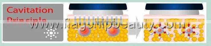 2011 new portable ultrasound slimming system