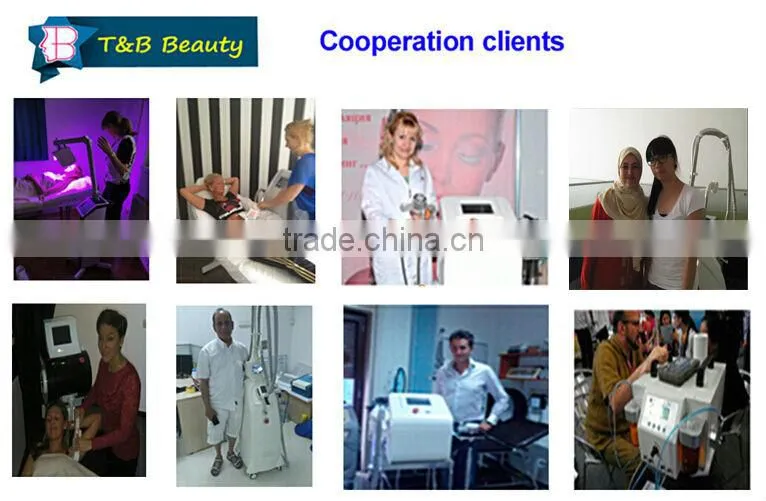 10.000.000 shot full body laser hair removal