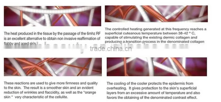 (CE) keywords cavitation rf machine wrinkle remove skin lifting rf and bio infrared skin tightening machine
