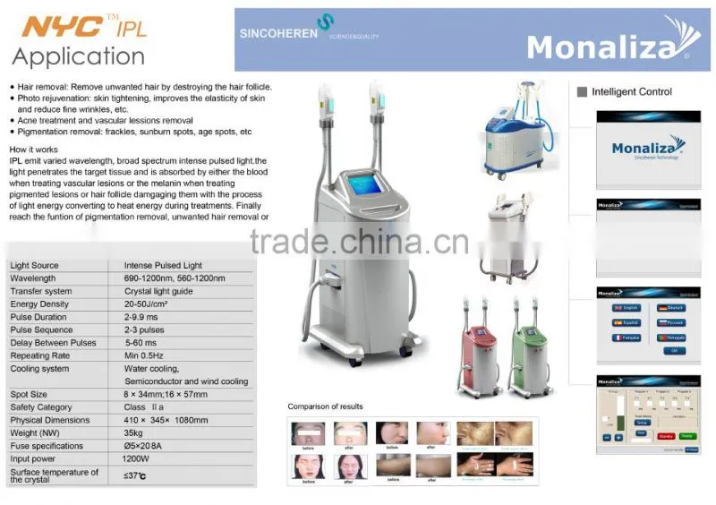 high quality 2016 super laser cutera shr ipl / ipl shr machine