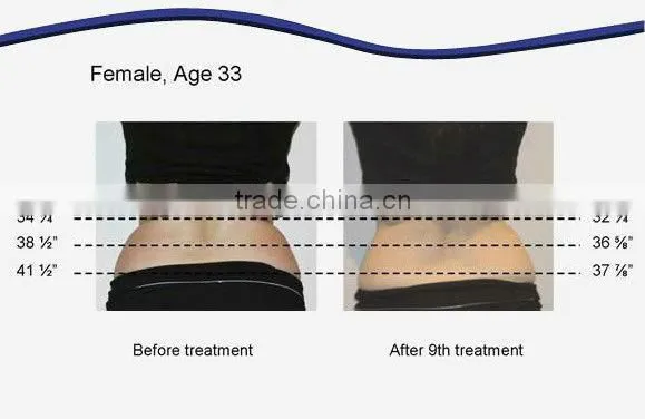 Lipo Laser Diode Laser Slimming Machine For Fat Reduction Weight Loss