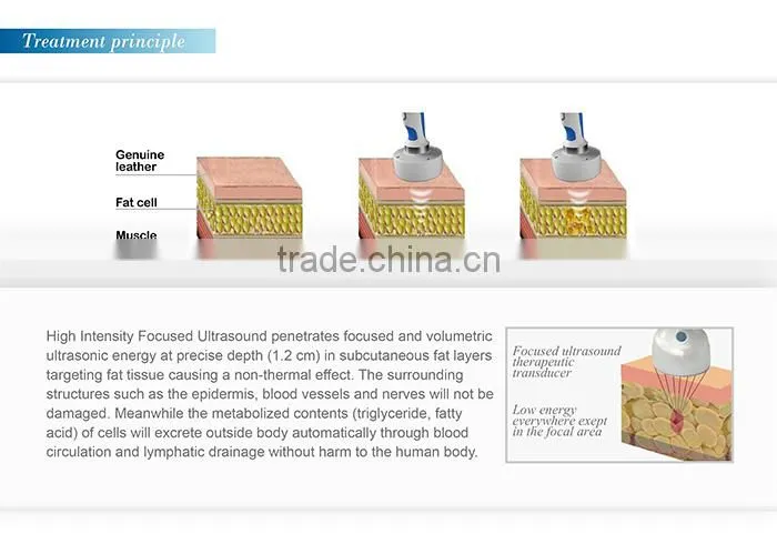 PROMOTION!New beauty for 2015 High Quality Ultrasonic wave slim HIFU Slimming machine