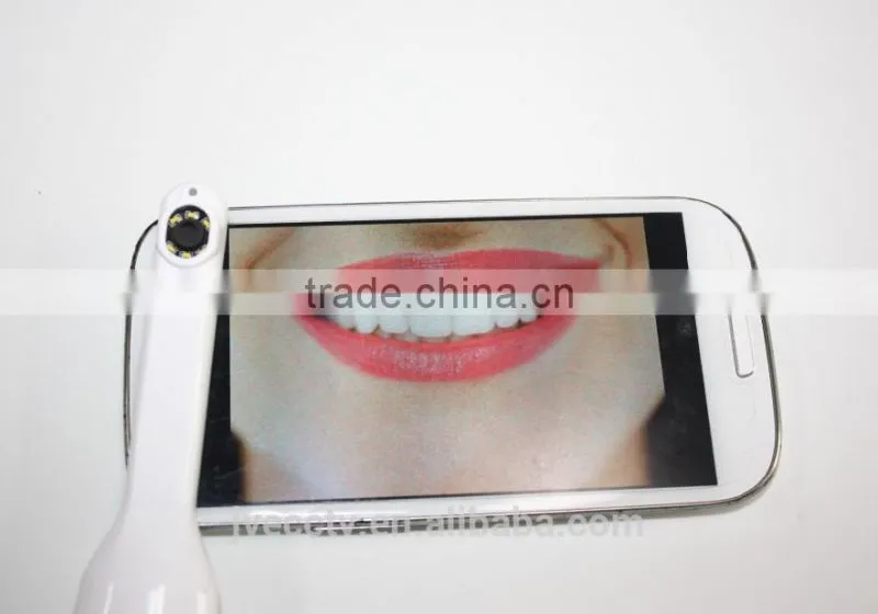 Factory oem 720P Wifi Intraoral Camera