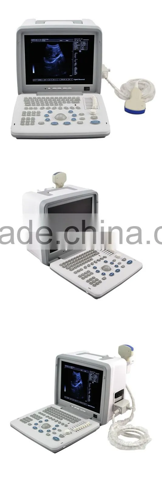 12-inch LCD monitor Full Digital LED portable ultrasound scanner price