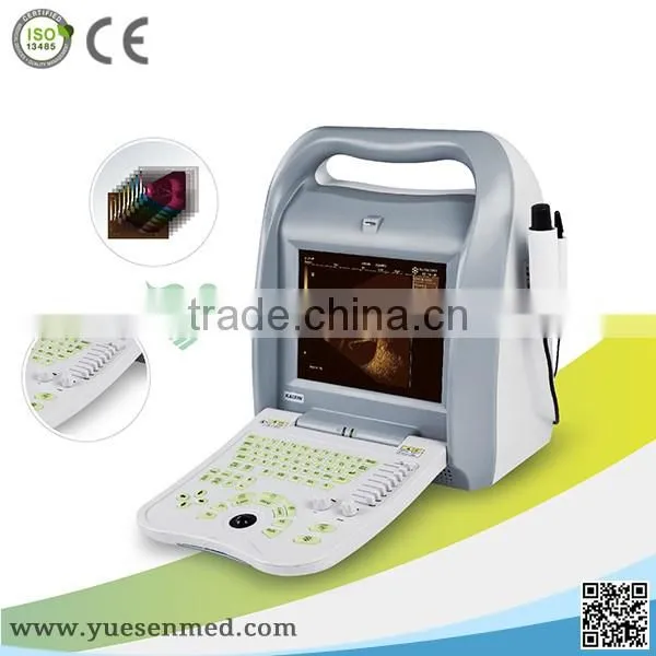 High performance portable cheapest ophthalmic ultrasound ab scan price