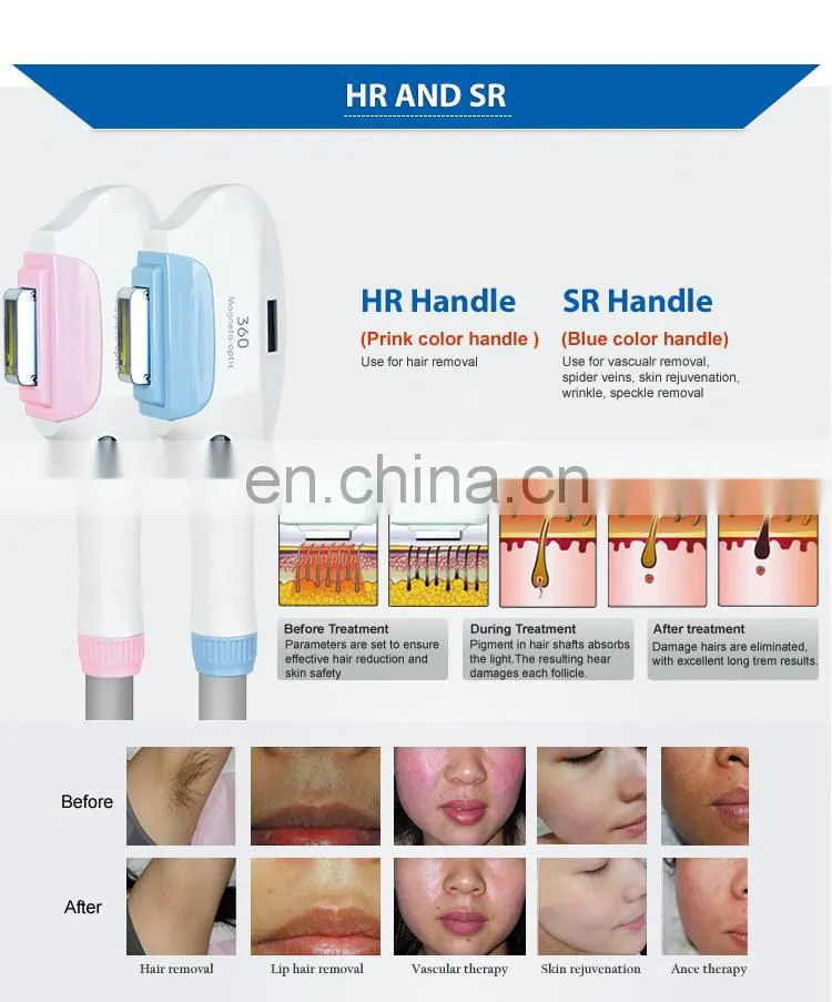 New 2022 Trending Product 4 in 1 Double IPL Hair Removal Machine with LASER RF Handle For Sale