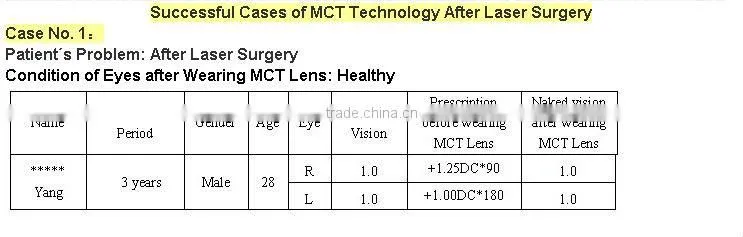 After Laser Surgery/MCT-L/High-end MCT Technology improve of OK Lenses