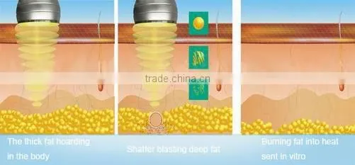 Portable Radio Frequency System Cavitation Cellulite System Ultrasonic Fat Cavitation Slimming Machine