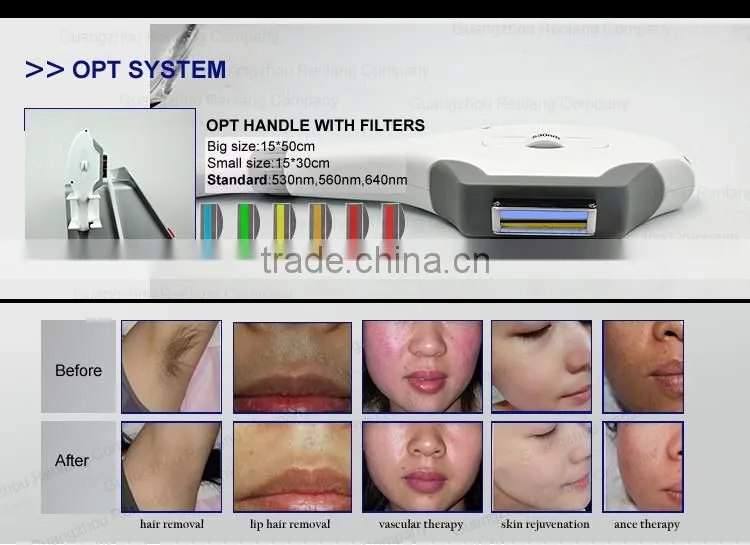 2016 permanent diode laser hair removal machine/pain free laser shr machine