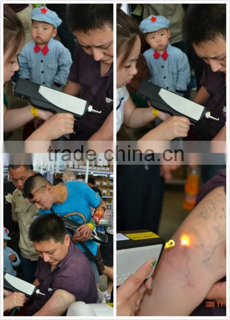 shr /ipl/rf/laser tattoo/elight beauty equipment