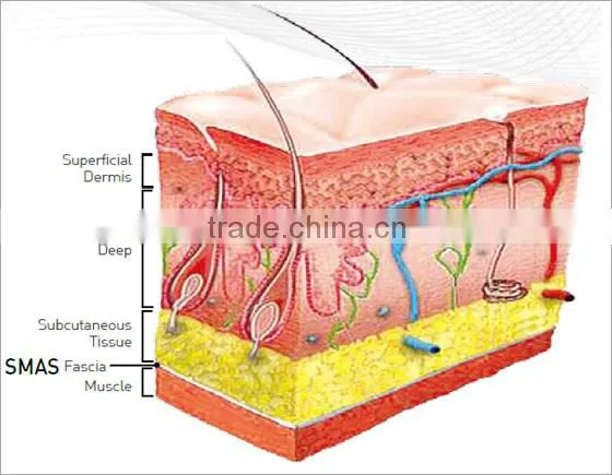 YUWEI-Best effect competitive price multifunction portable high intensity focused ultrasound skin care equipment