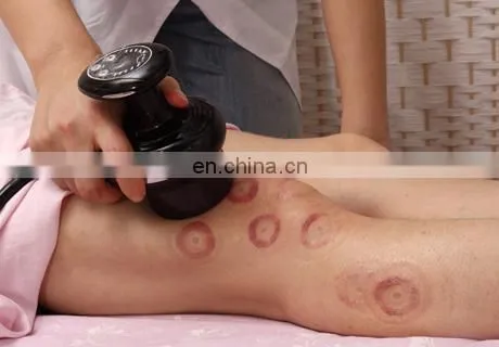 Meridian Massager Traditional Chinese Cupping therapy And Scraping Massage Electric Vacuum Cupping Therapy