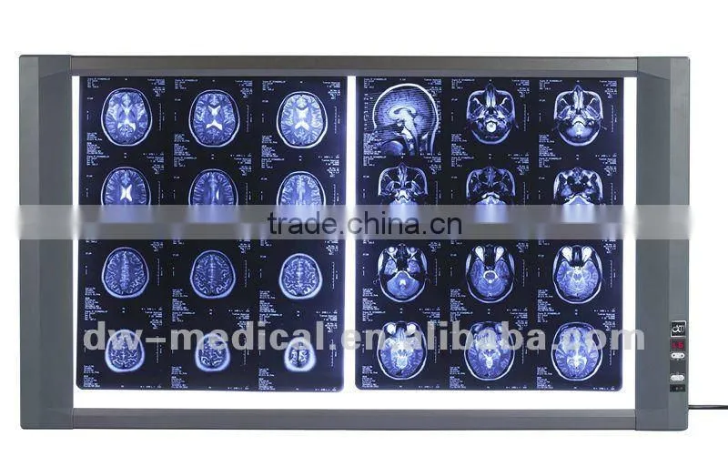 x ray machine two panel film viewer