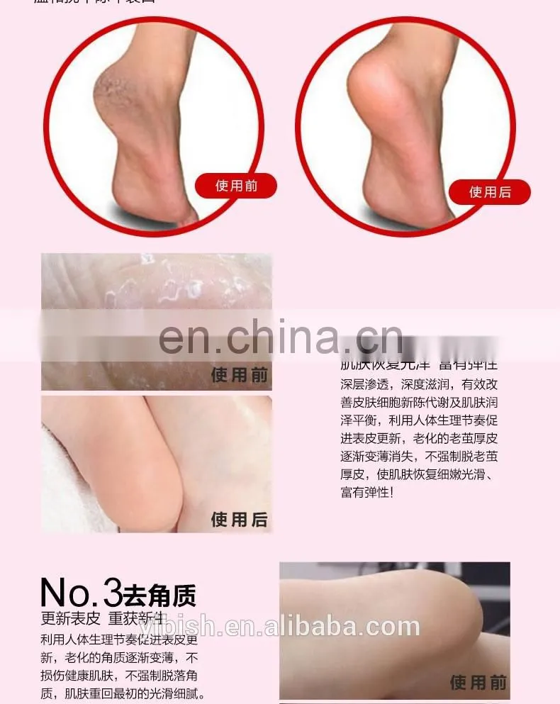 Ultra Comfortable Plantar Fasciitis Silicone Gel Heel Protective Support Sleeve - protecting cracked/dry heels #HG-011