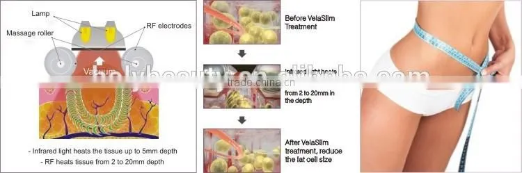 Rf Velaslim Infrared Light Therapy Vacuum Roller Velas Body Slimming Machine