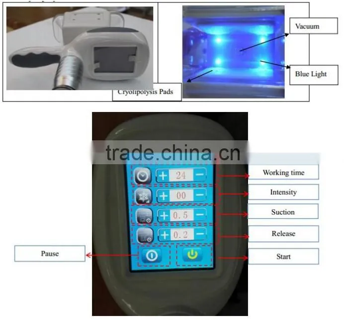 2016 NEW 2 handpiece kryolipolyse gerat / cryolipolyse kryolipolyse slimming machine / cryolipolyse machine